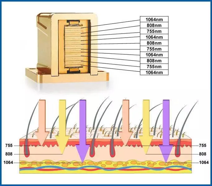 Ipl Diode Laser 808nm 755nm 1064nm Hair Removal Cosmetic Beauty Machine Ice Titanium Platinum Triple Waves Depilaction Medical Equipment Prices